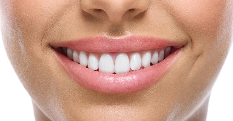 Dentes perfeitos