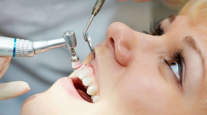 limpeza dental