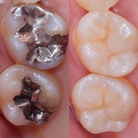 dentística